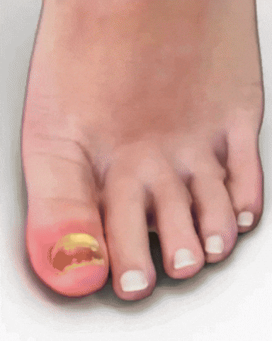 Brzi oporavak noktiju NailRepair